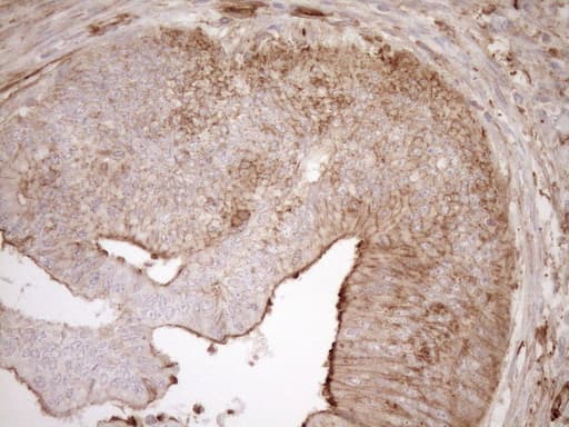 Monoclonal Mouse anti-Human ASPDH Antibody (clone OTI4G8, IHC)