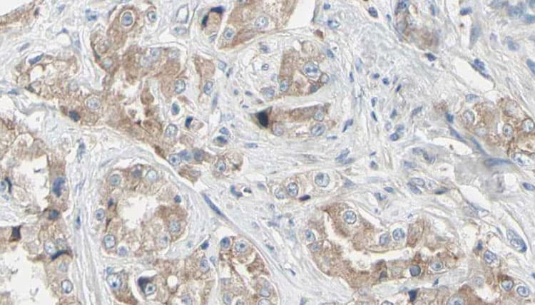 Polyclonal Rabbit anti-Human NT5C2 Antibody (IHC, WB)