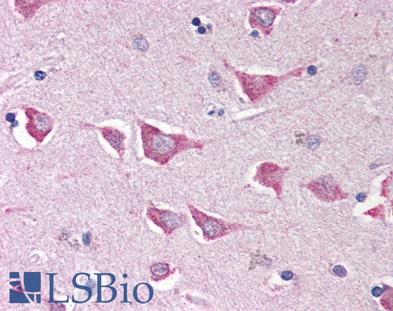 IHC-plus™ IPAF / NLRC4 Antibody