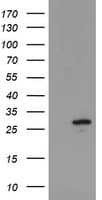 UBE2S / E2 EPF Antibody (clone OTI4E4)