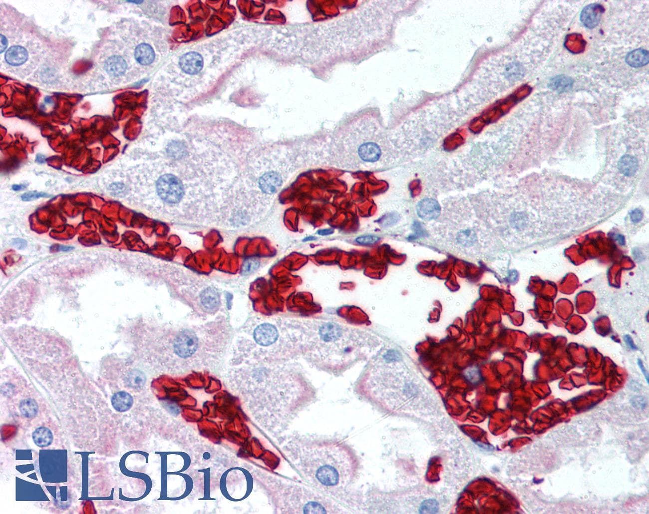 IHC-plus™ Monoclonal Mouse anti-Human Glycophorin A+B Antibody (clone HIR2, IHC)