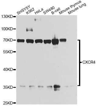 IHC-plus™ Monoclonal Rabbit anti-Human CXCR4 Antibody (IHC, WB)