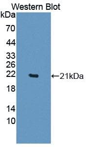 EDN2 / Endothelin 2 Antibody (aa32-178)