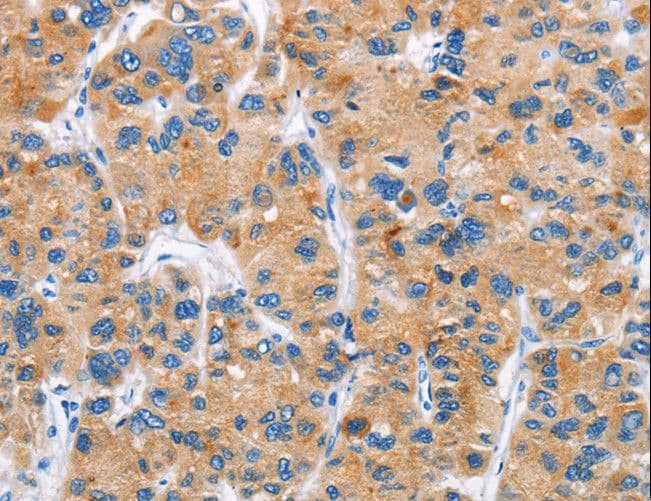 Polyclonal Rabbit anti-Human DKK2 Antibody (IHC)