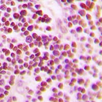 CDC25A Antibody (phospho-Ser75)