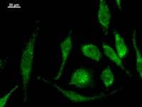 MOB2 Antibody (clone 2400C3a)
