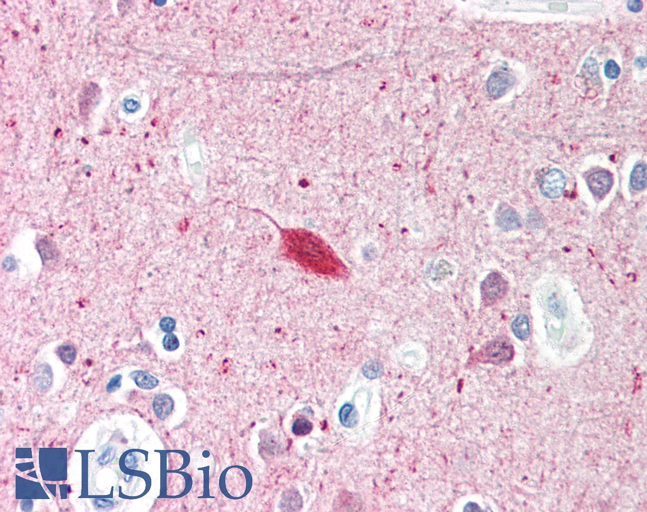 IHC-plus™ SMARCAL1 Antibody (aa75-100)