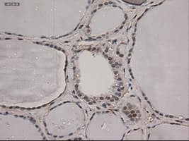 NOTCH1 Antibody (clone OTI3E12)