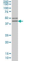 IHC-plus™ Monoclonal Mouse anti-Human SGCB / SGC / Sarcoglycan Beta Antibody (clone 1C10, IHC, IF, WB)