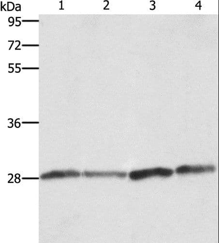 BCAP31 / BAP31 Antibody