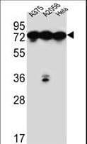 Polyclonal Rabbit anti-Human HSPA5 / GRP78 / BiP Antibody (aa541-568, IHC, WB)