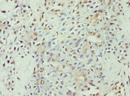 APOL1 / Apolipoprotein L Antibody (aa179-398)