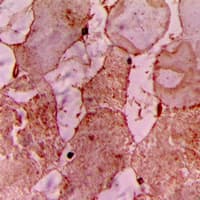 TNNI3K / CARK Antibody (Internal)