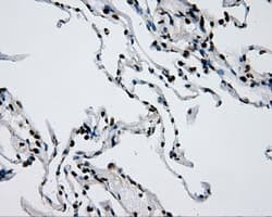 RPA2 / RFA2 / RPA34 Antibody (clone OTI9A1)