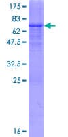 Human ADHFE1 Protein (Recombinant GST)