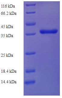 Human NIP7 Protein (Recombinant His-SUMO)