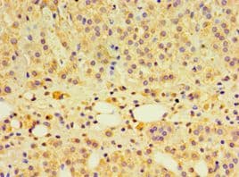 Polyclonal Rabbit anti-Human PCDHA6 Antibody (aa1-230, IHC)