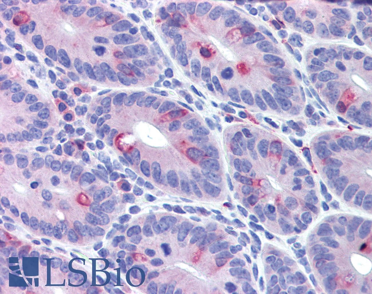 IHC-plus™ IFIH1 / MDA5 Antibody