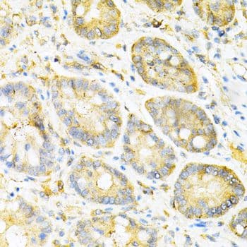 Polyclonal Rabbit anti-Human SULT2A1 / Sulfotransferase 2A1 Antibody (IHC, WB)