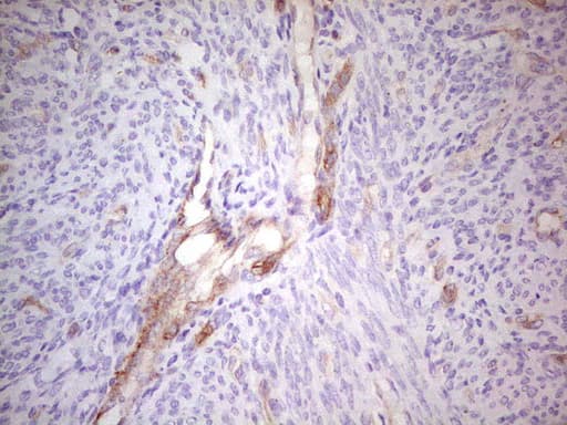 ABCB1 / MDR1 / P Glycoprotein Antibody (aa995-1280, clone OTI10H3, Carrier-free)