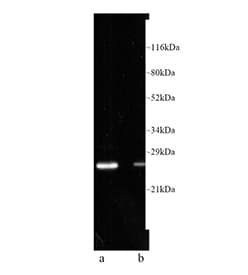 PSMB8 / LMP7 Antibody (clone LMP7-1)