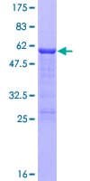 Human CITED2 Protein (Recombinant GST)
