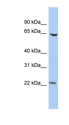 Polyclonal Rabbit anti-Human SCMH1 Antibody (aa251-300, WB)
