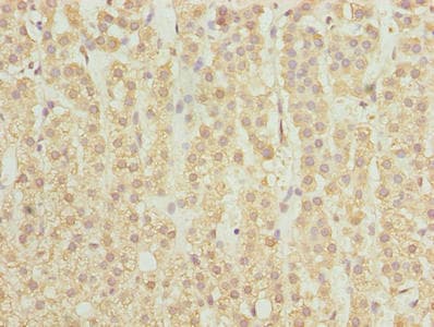 SPTLC2 / LCB2 Antibody (aa88-562)