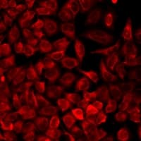 ALAS2 Antibody