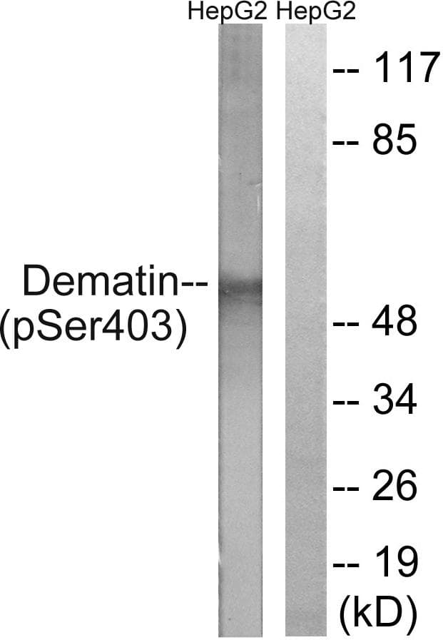 DMTN / Dematin Antibody (phospho-Ser403)