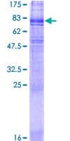 Human SLC6A3 / Dopamine Transporter Protein (Recombinant GST)