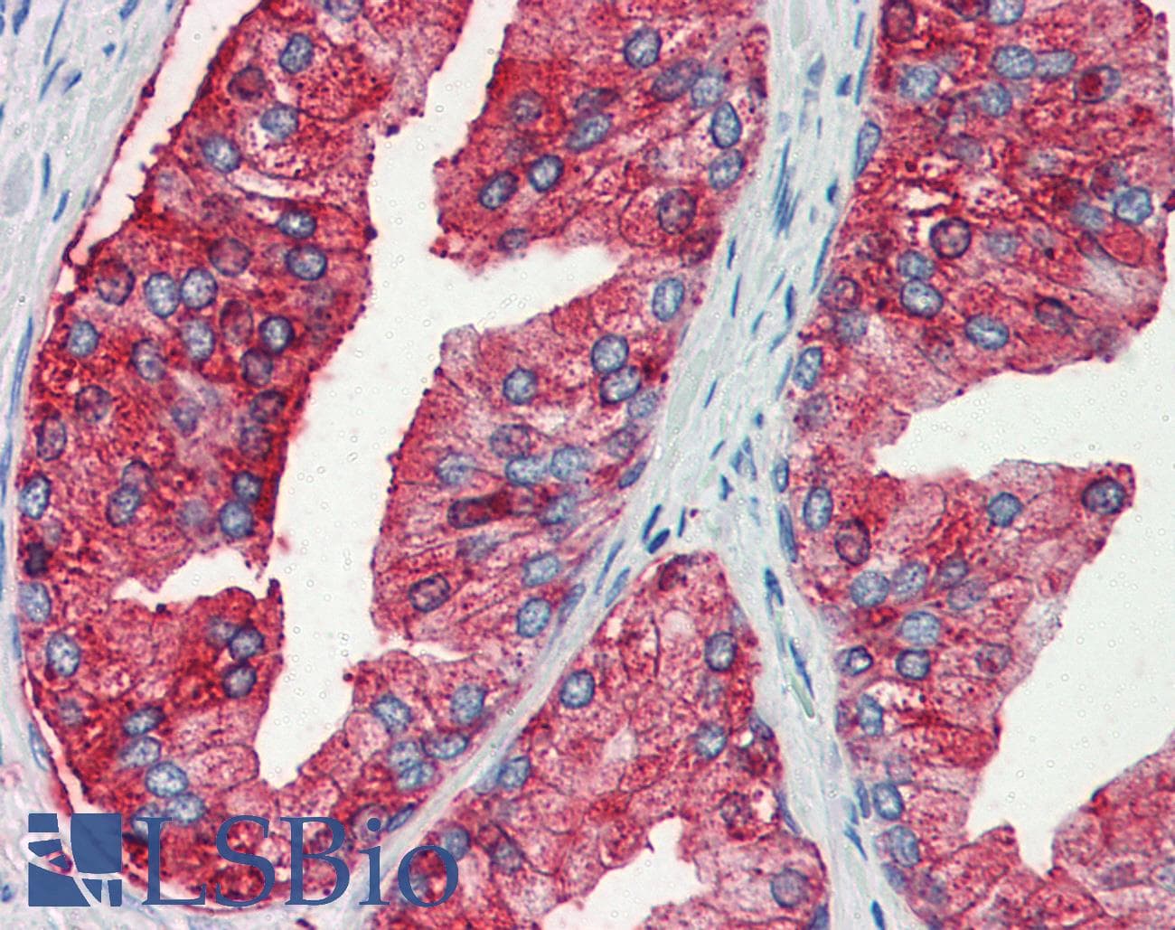 IHC-plus™ MUC13 Antibody (Internal)