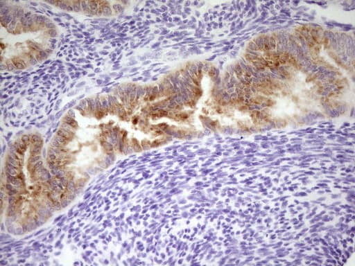 Monoclonal Mouse anti-Human LPIN3 / Lipin-3 Antibody (clone OTI1D7, IHC, WB)