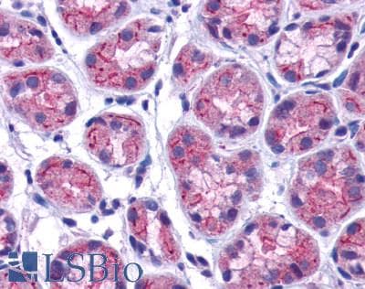 PathPlus™ Polyclonal Rabbit anti-Human GPRC5C Antibody (C-Terminus, IHC)