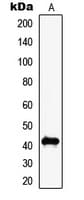 MAGEC2 / CT10 Antibody (Internal)