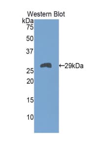 TNNT1 / TNT Antibody (aa1-228)