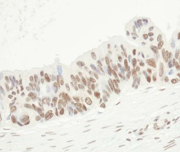 FUS / TLS Antibody (aa1-50)