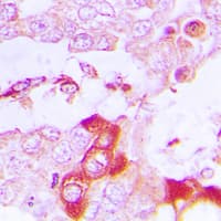 Polyclonal Rabbit anti-Human TRAF3IP3 Antibody (Internal, IHC, WB)