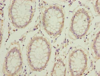 COMMD2 Antibody