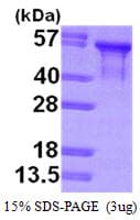 Human MAPT / Tau Protein (Recombinant His)