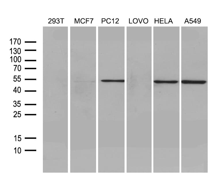FSCN1 / Fascin Antibody (clone OTI3D2)