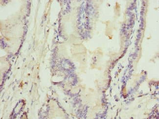 RTKN / Rhotekin Antibody