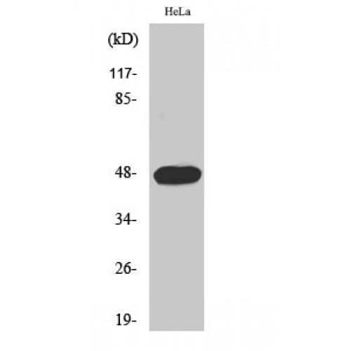 Polyclonal Rabbit anti-Human CCNE1 / Cyclin E1 Antibody (330-410 aa, IHC, WB)