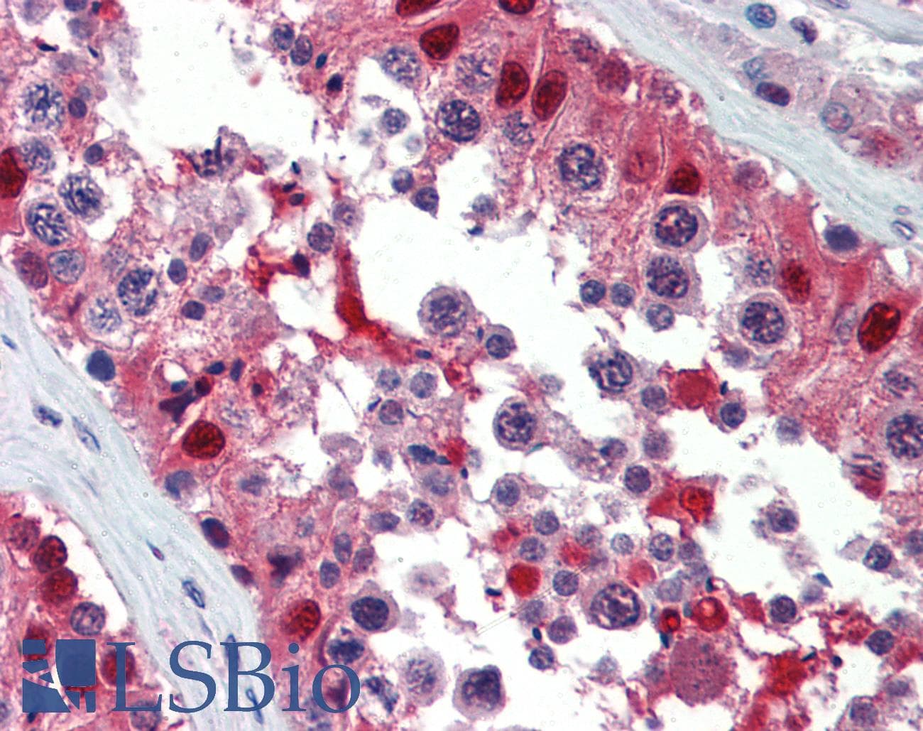 IHC-plus™ Monoclonal Mouse anti-Bovine Ubiquitin Antibody (IHC, IF, WB)