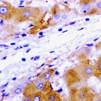 UBC6 / UBE2J2 Antibody