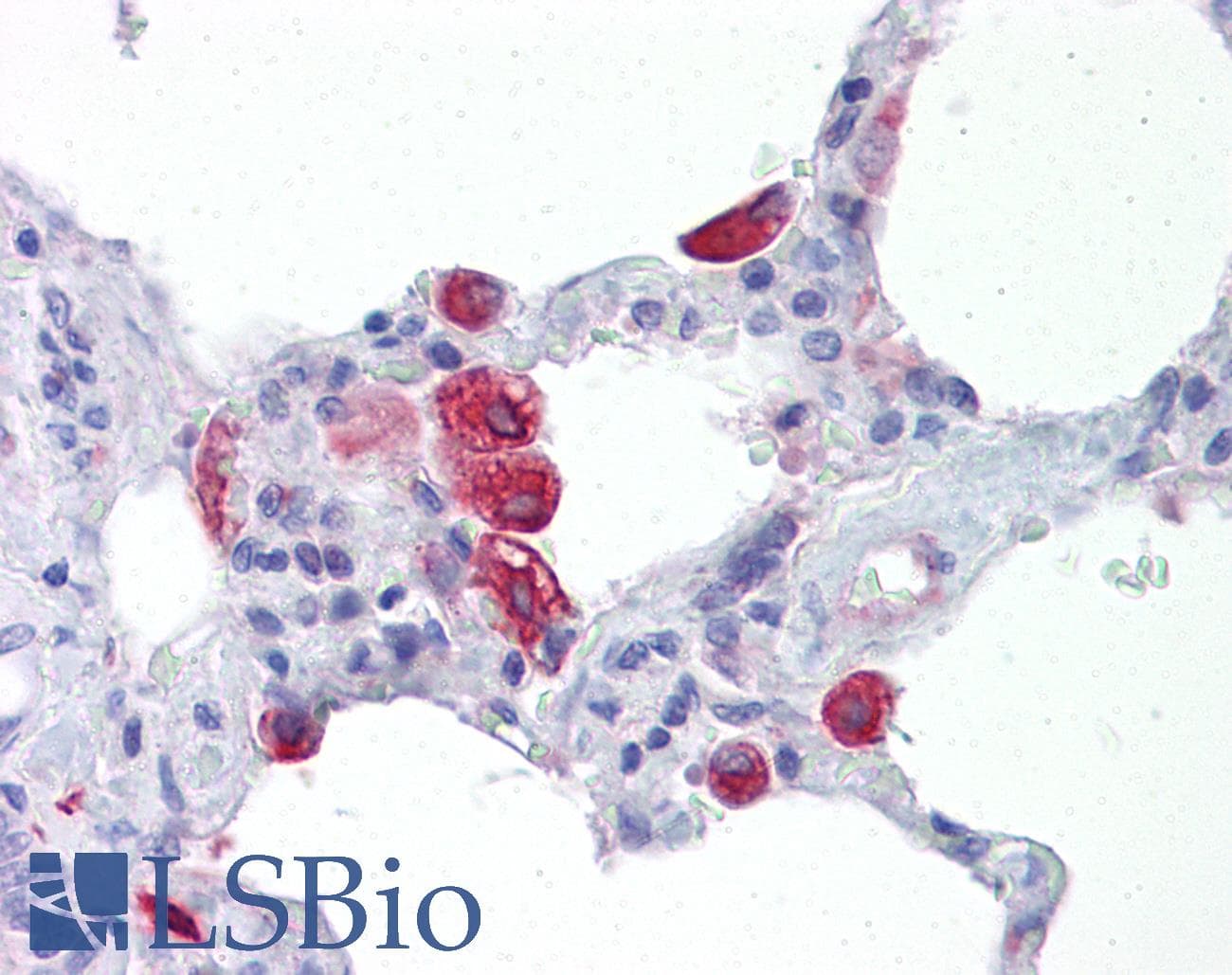 IHC-plus™ OGFOD2 Antibody