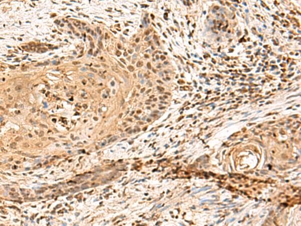 PTHR / PTHR1 Antibody
