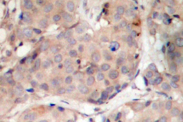 Polyclonal Rabbit anti-Human PDPK1 / PDK1 Antibody (phospho-Ser241, IHC, WB)