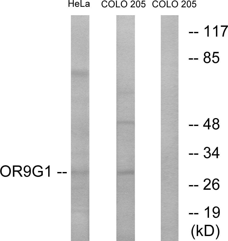Polyclonal Rabbit anti-Human OR9G1 Antibody (WB)