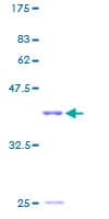 Human HIST1H2BC Protein (Recombinant GST)